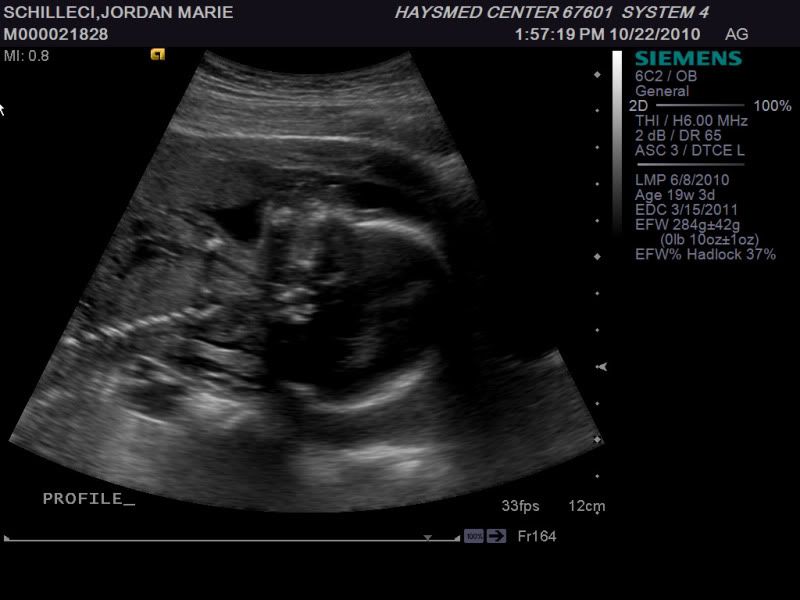 Week 19 Ultrasound