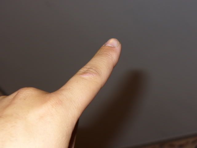 finger.jpg